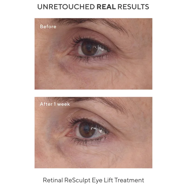 Cult Murad Retinal ReSculpt Eye Treatment 15ml