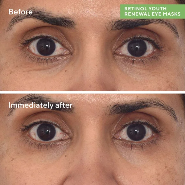 Cult Murad Retinol Youth Renewal Eye Masks (5 Pack)