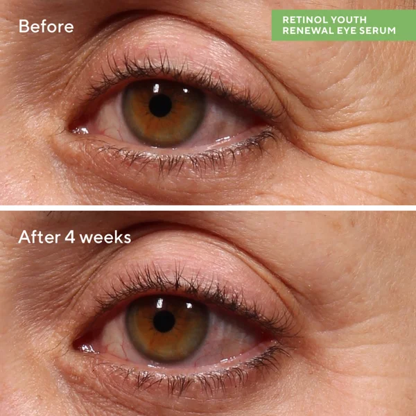 Cult Murad Retinol Youth Renewal Eye Serum 15ml