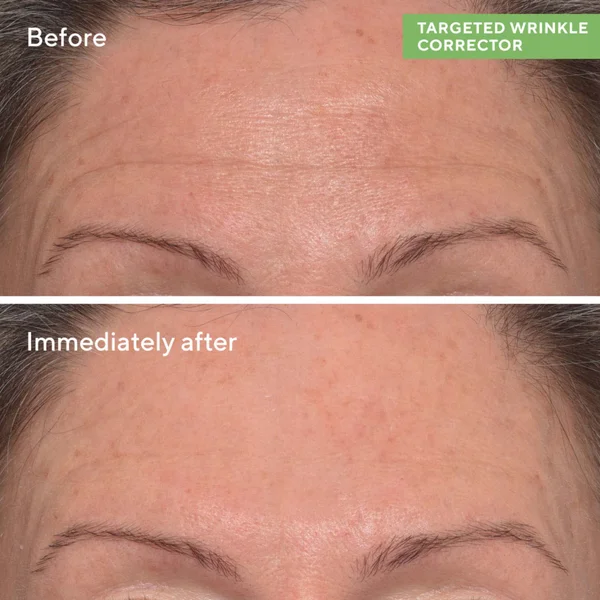 Cult Murad Targeted Wrinkle Corrector 15ml