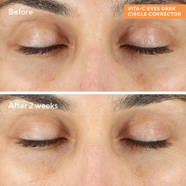 Cult Murad Vita-C Eyes Dark Circle Corrector 15ml
