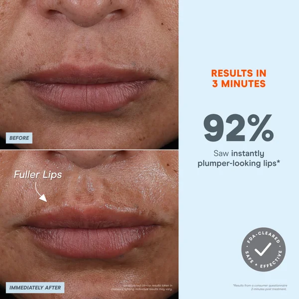 Cult NuFACE FIX Microwand