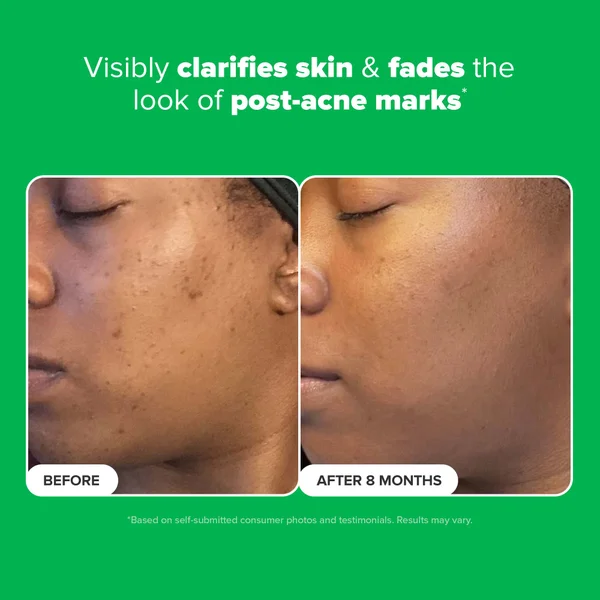 Cult Paula's Choice 10% Azelaic Acid Booster 30ml