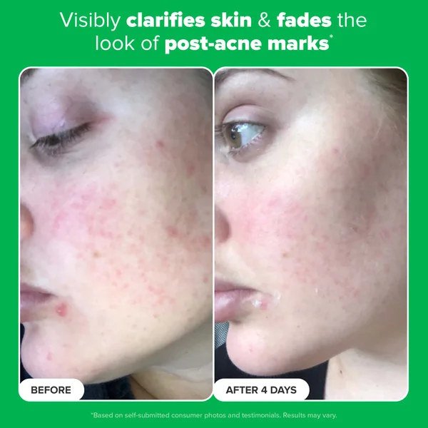 Cult Paula's Choice 10% Azelaic Acid Booster 30ml