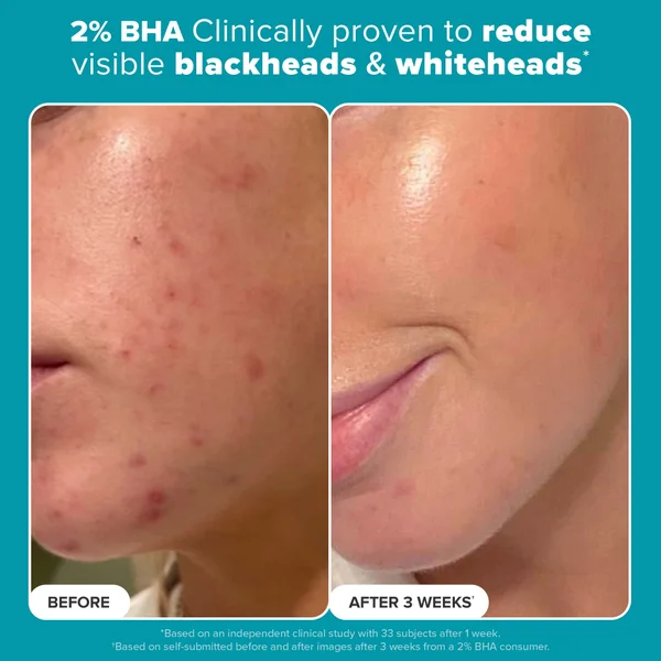 Cult Paula's Choice Multi-Level Exfoliation Kit