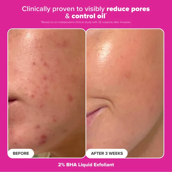 Cult Paula's Choice The Plump & Glow Kit