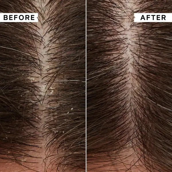 Cult Philip Kingsley Flaky/Itchy Scalp 8-Day Kit