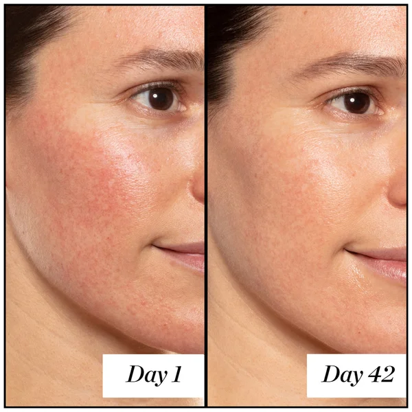 Cult Sunday Riley A+ High-Dose Retinoid Serum 50ml