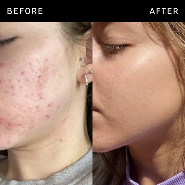 Cult The INKEY List Niacinamide Serum 30ml