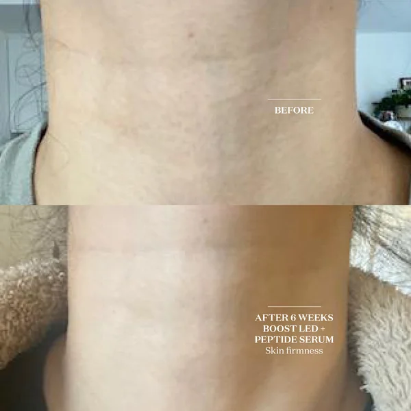 Cult The Light Salon Boost LED Collar