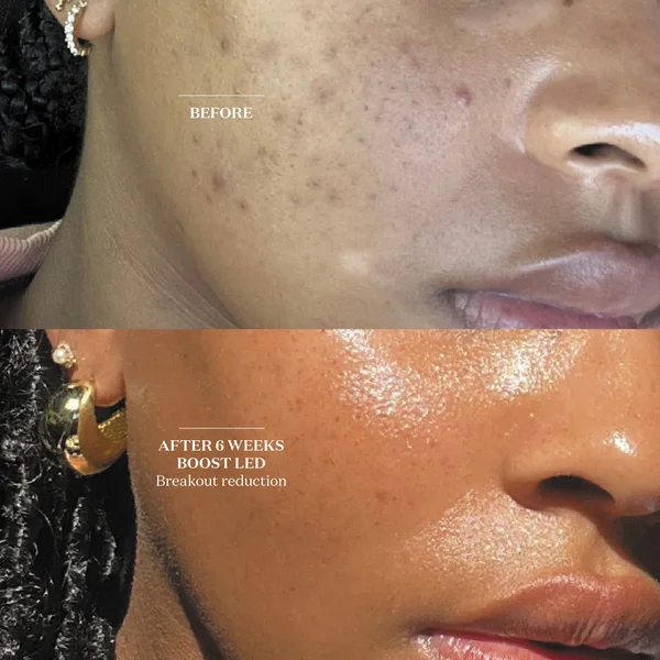 Cult The Light Salon Boost LED Mask