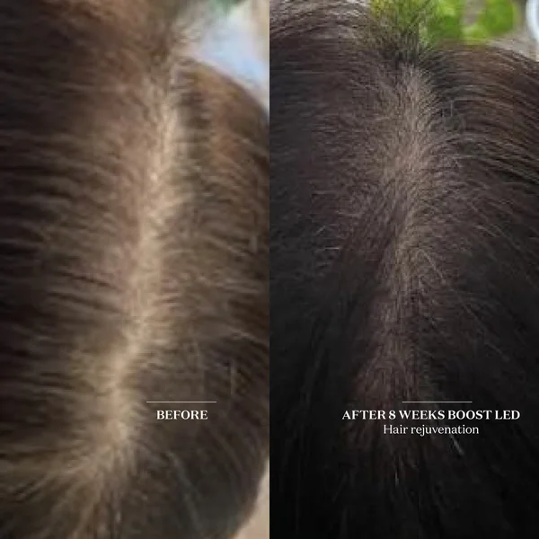 Cult The Light Salon Boost LED Patch