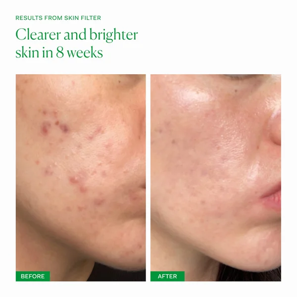 Cult The Nue Co. Skin Filter (30 Capsules)