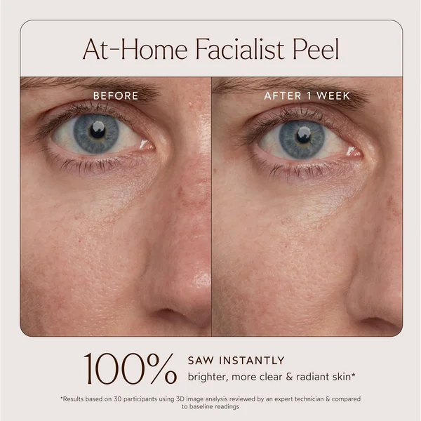 Cult True Botanicals At-Home Facialist Peel 30ml