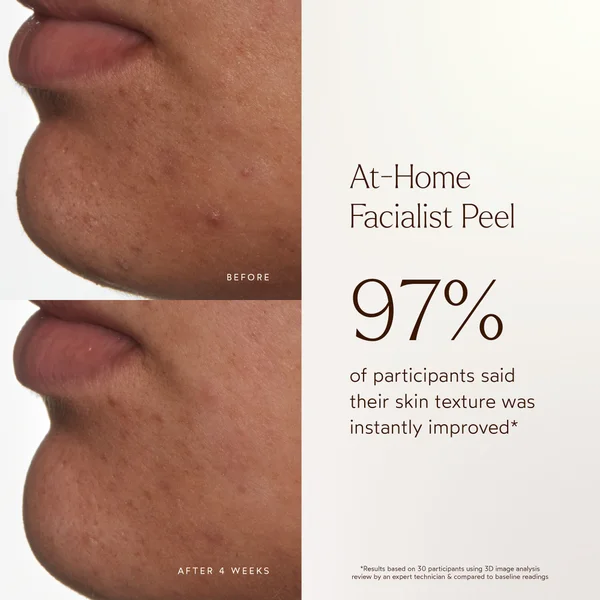 Cult True Botanicals At-Home Facialist Peel 30ml