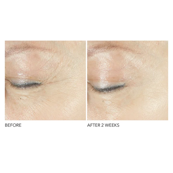 Cult Dr. Dennis Gross Skincare Advanced Retinol + Ferulic Triple Correction Eye Serum