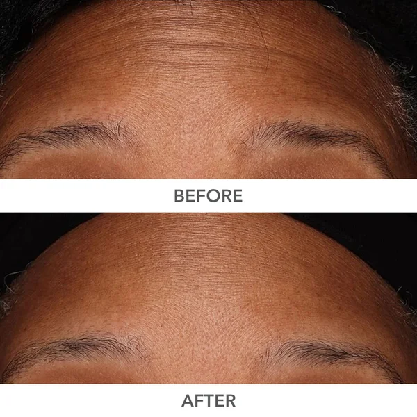 Cult Dr Dennis Gross Skincare DermInfusions Plump Fill And Repair Kit