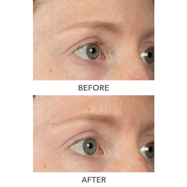 Cult Dr Dennis Gross Skincare DermInfusions Plump Fill And Repair Kit