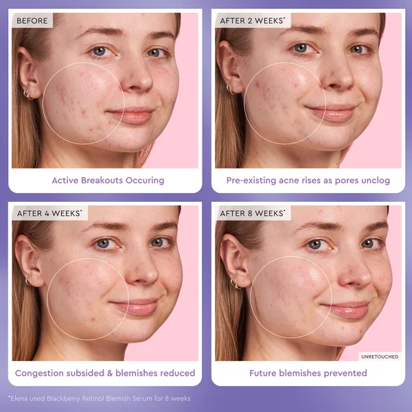 Cult Glow Recipe Blackberry Retinol Blemish Serum 30ml