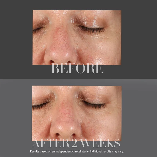 Cult Kate Somerville KateCeuticals Resurfacing Overnight Peel 30ml