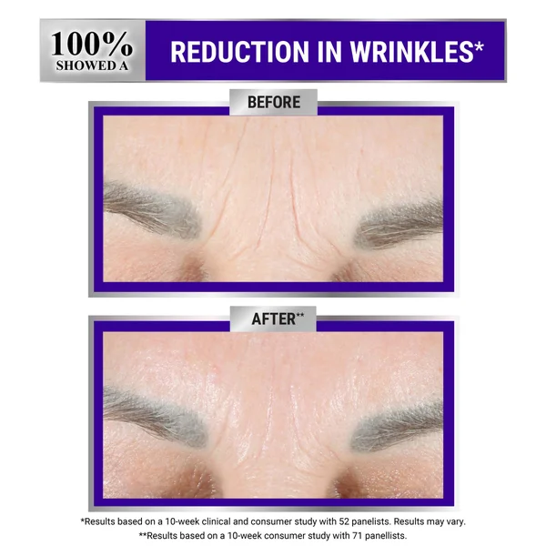 Cult Kiehl's Retinol Skin-Renewing Daily Micro-Dose Serum - 30ml
