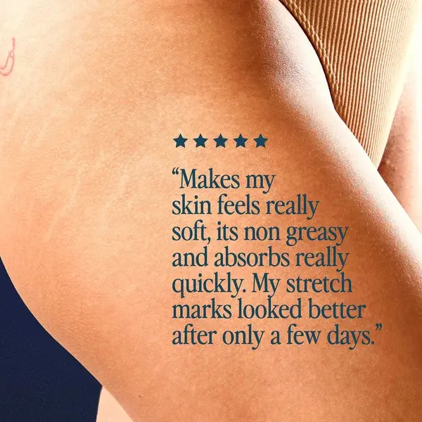 Cult Luna Daily The Skin Support Oil For Stretch Marks And Hyperpigmentation 100ml