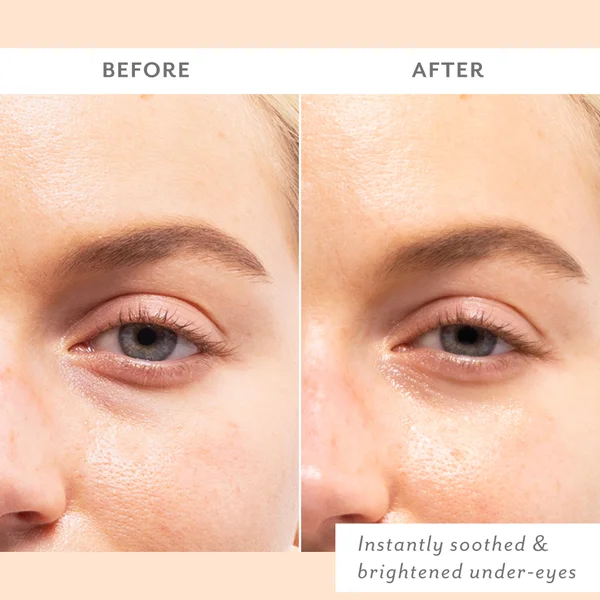 Cult Patchology Skin Remedy Soothing Eye Gels - Single