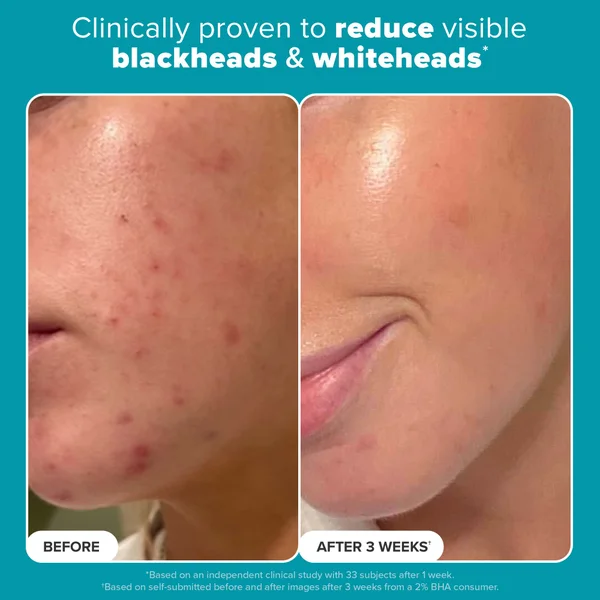 Cult Paula's Choice Skin Perfecting 2% BHA Liquid Exfoliant - Trial Size (30ml)