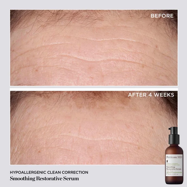 Cult Perricone MD Hypo Clean Correction Smoothing Restorative Serum 2oz FG