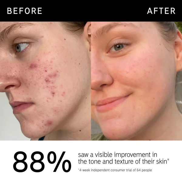 Cult The INKEY List- 15% Vitamin C And EGF Serum 30ml