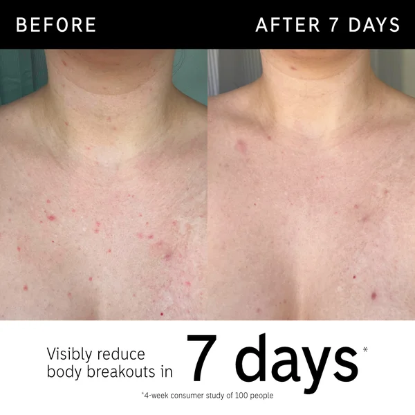 Cult The INKEY List Glycolic Acid Exfoliating Body Stick 45g