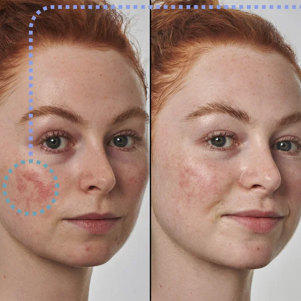 Cult The INKEY List Super Solutions 10% Azelaic Acid Serum 30ml