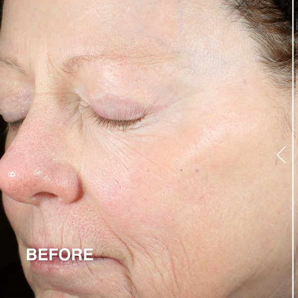 Derma E Advanced Peptides & Flora-Collagen™ Cryo-Gel Mask