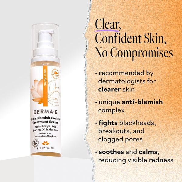 Derma E Acne Treatment Serum For Blemish Control