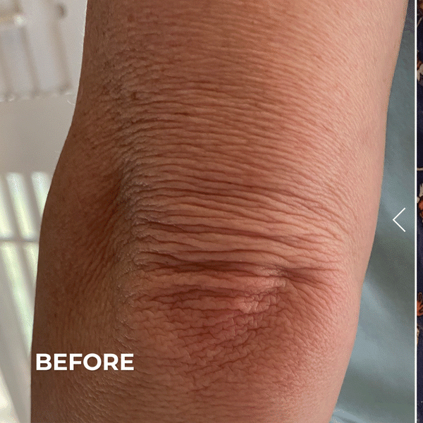 Derma E Crepey Skin Repair Treatment