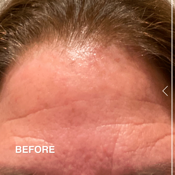 Derma E Ferulic Acid Resurfacing Pads