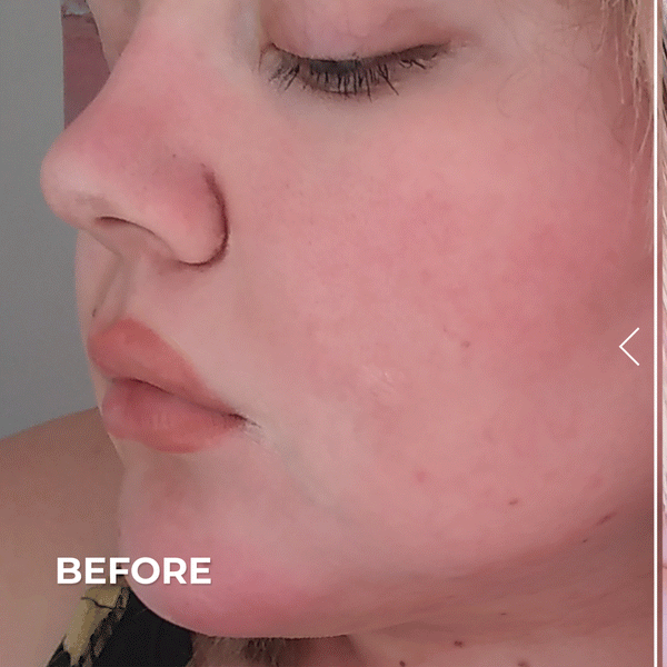 Derma E Pure Biome Balancing Cleanser