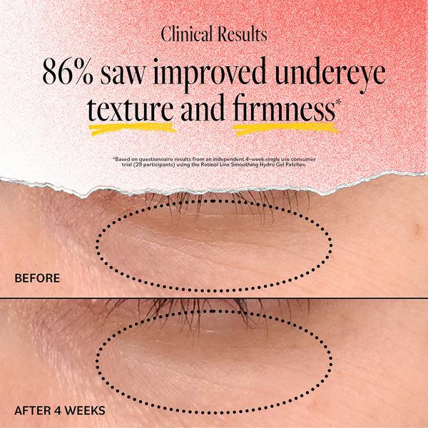 Derma E Retinol Line Smoothing Hydro Gel Patches