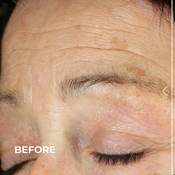 Derma E Ultra Lift DMAE Concentrated Serum