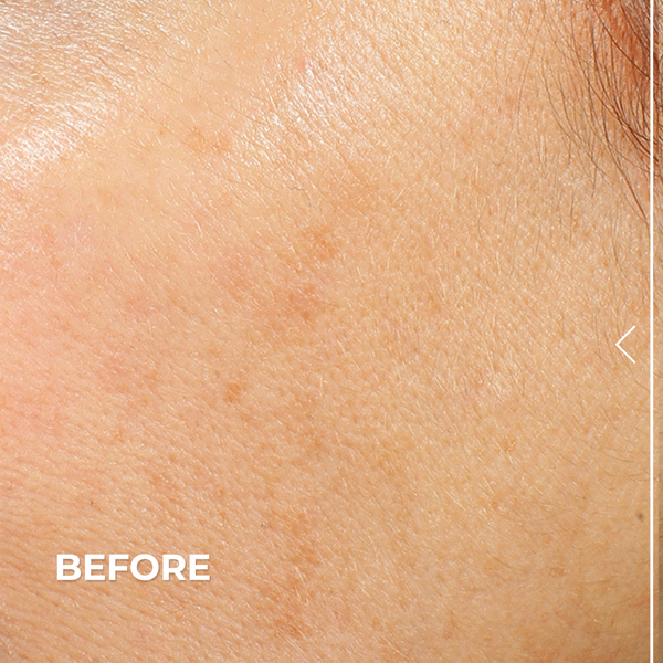 Derma E Vitamin C Bright Start Sets