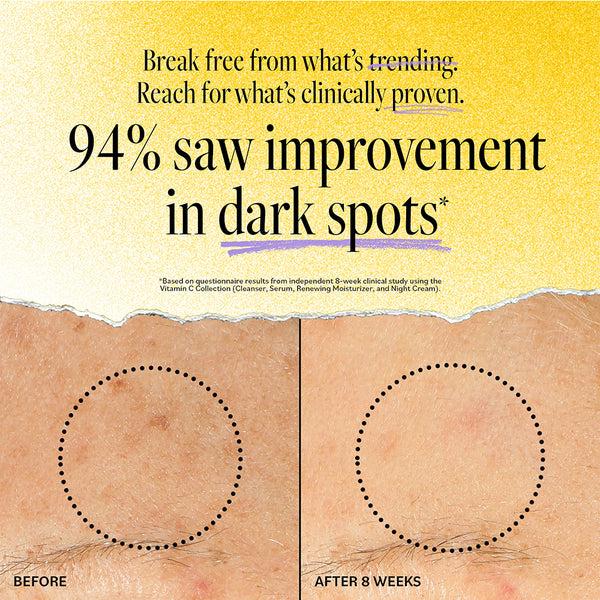 Derma E Vitamin C Renewing Moisturizer