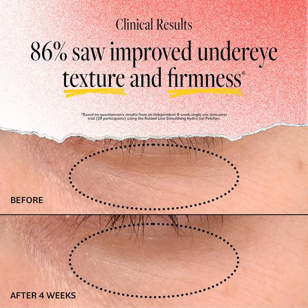 Derma E Retinol Line Smoothing Hydro Gel Patches (5 Pack)