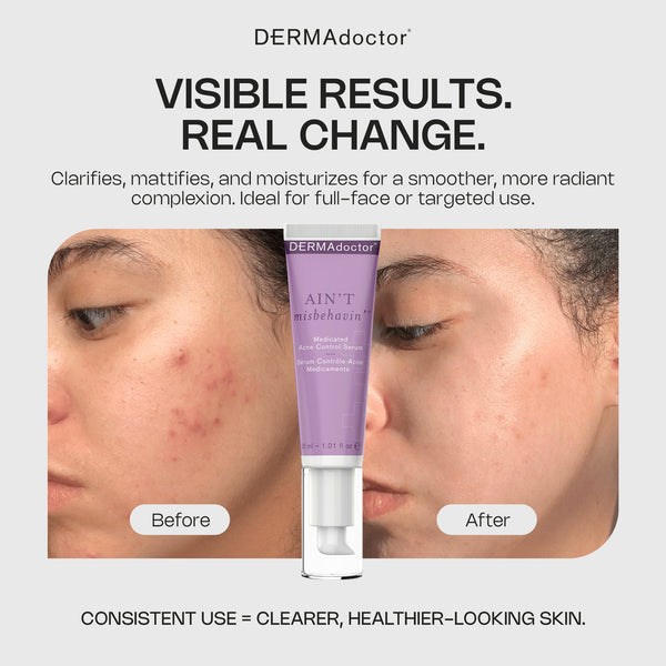 Dermadoctor Ain't Misbehavin' Medicated Acne Control Serum
