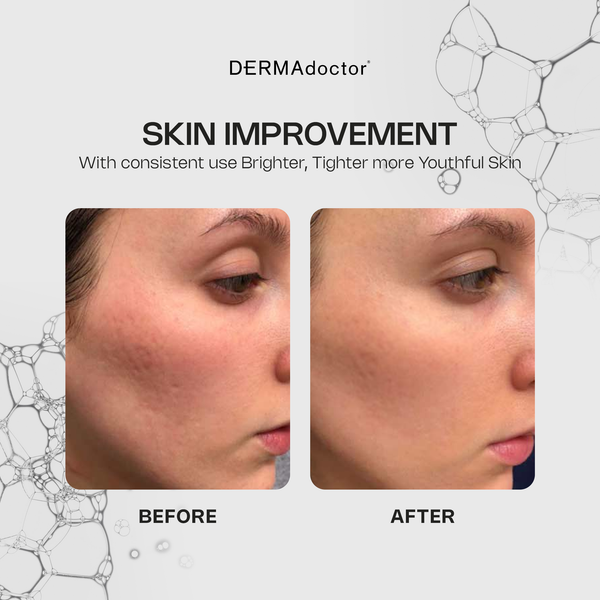 Dermadoctor Kakadu C 20% Vitamin C Serum With Ferulic Acid & Vitamin E