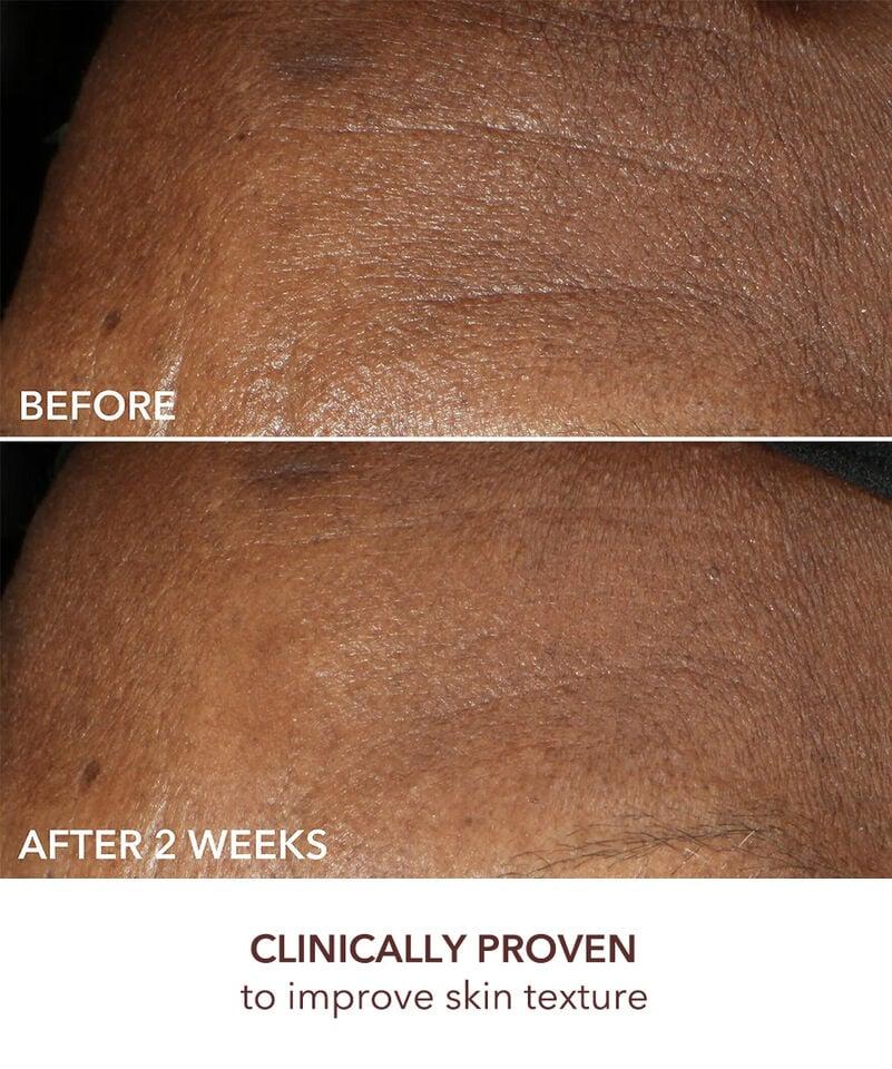 Dr Dennis Gross Advanced Retinol + Ferulic Intense Wrinkle Cream