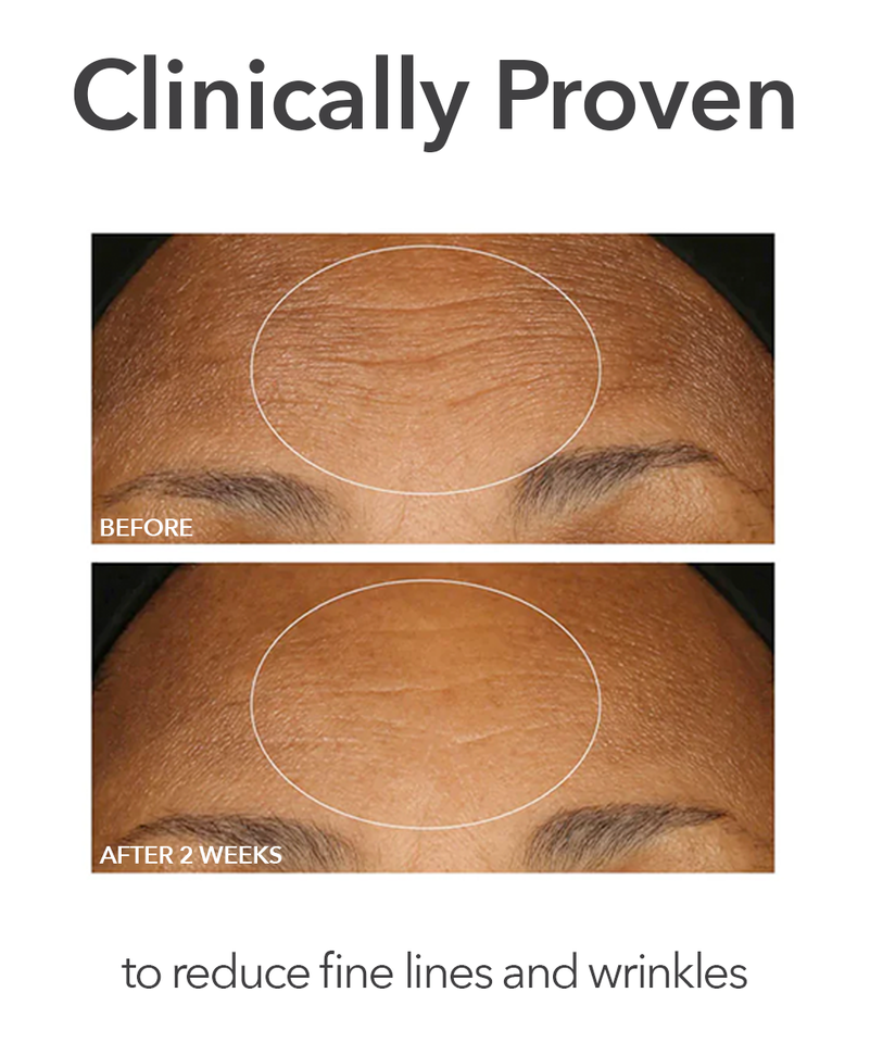 Dr Dennis Gross Alpha Beta® Extra Strength Daily Peel