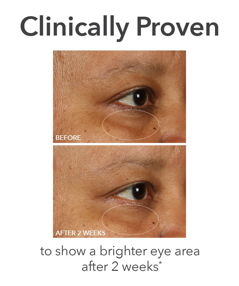 Dr Dennis Gross DermInfusions™ Fill + Repair Eye Cream With Hyaluronic Acid