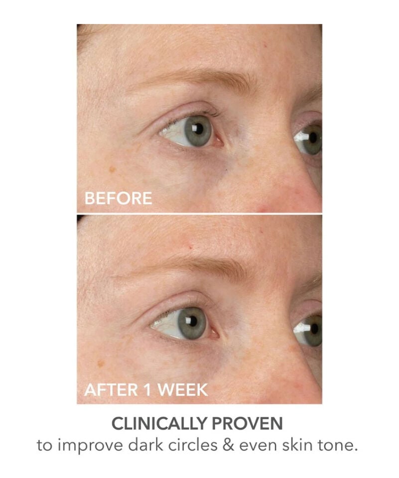 Dr Dennis Gross DermInfusions™ Lift + Repair Eye Mask