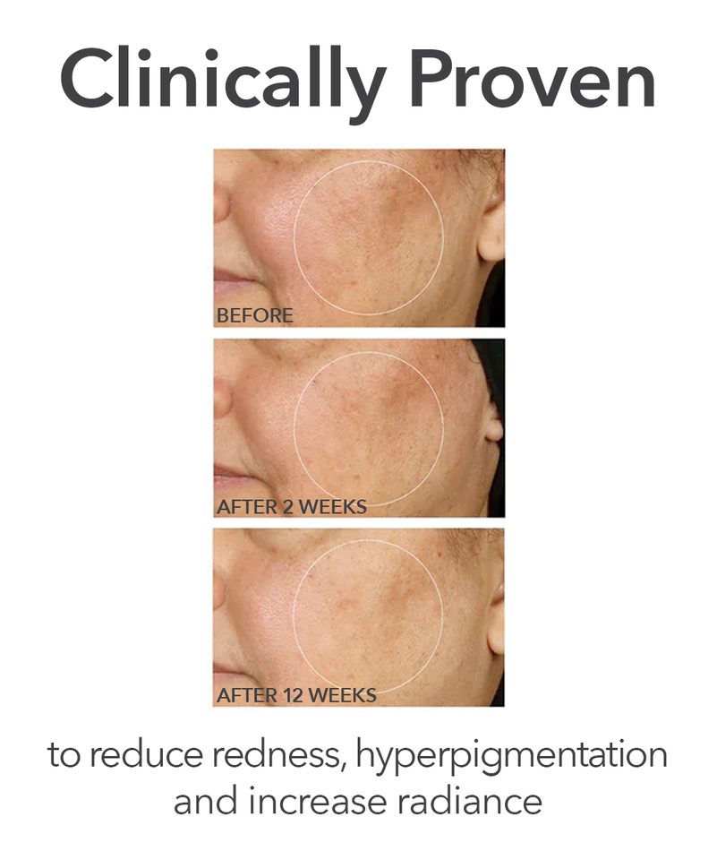 Dr Dennis Gross Alpha Beta® Universal Daily Peel