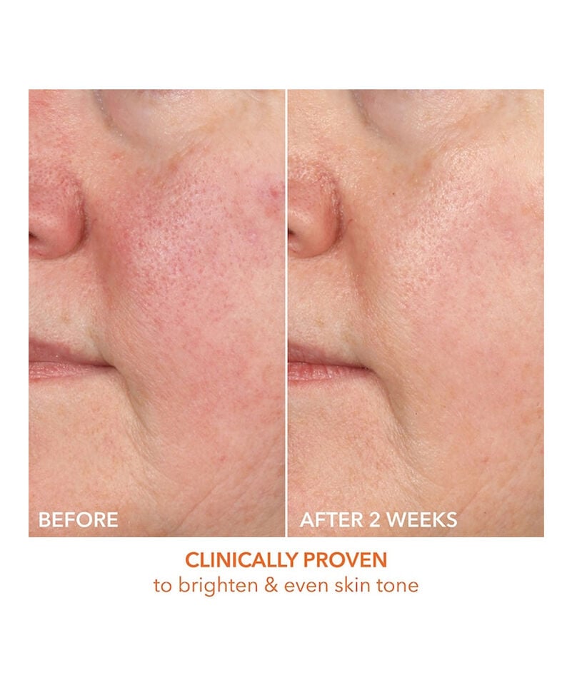 Dr Dennis Gross Vitamin C Lactic 15% Vitamin C Firm & Bright Serum